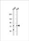 ATP Binding Cassette Subfamily B Member 10 antibody, PA5-49580, Invitrogen Antibodies, Western Blot image 
