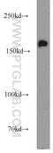 Ankyrin Repeat Domain 11 antibody, 55364-1-AP, Proteintech Group, Western Blot image 