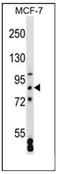 DNA-binding protein SATB2 antibody, AP53802PU-N, Origene, Western Blot image 