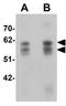 Nuclear Speckle Splicing Regulatory Protein 1 antibody, GTX16250, GeneTex, Western Blot image 