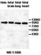 Heat Shock Protein Family H (Hsp110) Member 1 antibody, orb76917, Biorbyt, Western Blot image 