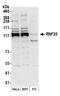 E3 ubiquitin-protein ligase BRE1A antibody, A300-714A, Bethyl Labs, Western Blot image 