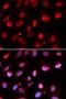 RING1b antibody, LS-C334144, Lifespan Biosciences, Immunofluorescence image 