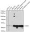 Corneodesmosin antibody, GTX66273, GeneTex, Western Blot image 