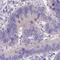 Rho Guanine Nucleotide Exchange Factor 35 antibody, HPA045619, Atlas Antibodies, Immunohistochemistry paraffin image 