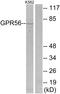 Adhesion G Protein-Coupled Receptor G1 antibody, A30830, Boster Biological Technology, Western Blot image 
