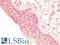 RB Transcriptional Corepressor 1 antibody, LS-B14693, Lifespan Biosciences, Immunohistochemistry paraffin image 