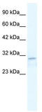 Insulin Like Growth Factor 2 MRNA Binding Protein 1 antibody, TA341728, Origene, Western Blot image 
