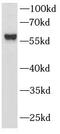 LCK Proto-Oncogene, Src Family Tyrosine Kinase antibody, FNab04727, FineTest, Western Blot image 