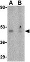 Calcium release-activated calcium channel protein 1 antibody, GTX85057, GeneTex, Western Blot image 