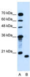 Peptidyl-tRNA hydrolase 2, mitochondrial antibody, TA336083, Origene, Western Blot image 