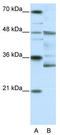 Forkhead Box N2 antibody, TA335849, Origene, Western Blot image 
