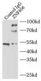 Zinc Finger Protein 606 antibody, FNab09719, FineTest, Immunoprecipitation image 