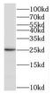 MAX Dimerization Protein 1 antibody, FNab05452, FineTest, Western Blot image 