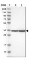 Poly(RC) Binding Protein 3 antibody, PA5-56413, Invitrogen Antibodies, Western Blot image 