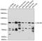 Unc-5 Netrin Receptor B antibody, GTX66317, GeneTex, Western Blot image 