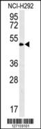 Zinc Finger Protein 154 antibody, 57-381, ProSci, Western Blot image 