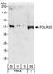 DNA-directed RNA polymerase III subunit RPC4 antibody, A302-296A, Bethyl Labs, Western Blot image 