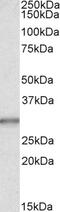 Heme oxygenase 2 antibody, 42-102, ProSci, Western Blot image 