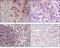5'-Nucleotidase Ecto antibody, abx016042, Abbexa, Enzyme Linked Immunosorbent Assay image 