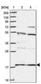 Ribosomal Protein S18 antibody, PA5-62147, Invitrogen Antibodies, Western Blot image 