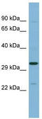 SET Nuclear Proto-Oncogene antibody, TA342203, Origene, Western Blot image 