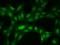 Tet Methylcytosine Dioxygenase 1 antibody, 202731-T02, Sino Biological, Immunohistochemistry paraffin image 