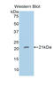 Sonic hedgehog protein antibody, LS-C294431, Lifespan Biosciences, Western Blot image 