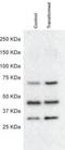 Deltex E3 Ubiquitin Ligase 1 antibody, NBP2-58472, Novus Biologicals, Western Blot image 