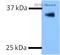 Cellular Communication Network Factor 2 antibody, ab6992, Abcam, Western Blot image 