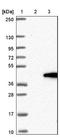 Family With Sequence Similarity 118 Member B antibody, NBP1-93958, Novus Biologicals, Immunohistochemistry frozen image 