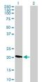 DIRAS Family GTPase 1 antibody, H00148252-B01P, Novus Biologicals, Western Blot image 