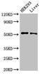 Interferon Induced Protein With Tetratricopeptide Repeats 2 antibody, CSB-PA011021LA01HU, Cusabio, Western Blot image 