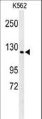 CST complex subunit CTC1 antibody, LS-B13171, Lifespan Biosciences, Western Blot image 