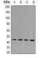 Serpin B3 antibody, orb340912, Biorbyt, Western Blot image 