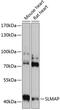 Sarcolemma Associated Protein antibody, 15-506, ProSci, Western Blot image 