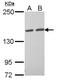 Tankyrase 1 Binding Protein 1 antibody, NBP2-20561, Novus Biologicals, Western Blot image 