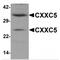 CXXC Finger Protein 5 antibody, MBS150962, MyBioSource, Western Blot image 