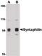 Syntaphilin antibody, PA5-20529, Invitrogen Antibodies, Western Blot image 