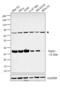 DT-diaphorase antibody, PA5-18022, Invitrogen Antibodies, Western Blot image 