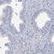 Protein Phosphatase 1 Regulatory Subunit 32 antibody, PA5-58647, Invitrogen Antibodies, Immunohistochemistry frozen image 