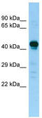Alpha-N-acetylgalactosaminidase antibody, TA343290, Origene, Western Blot image 