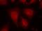 Histone deacetylase 8 antibody, 79-160, ProSci, Immunofluorescence image 