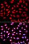 Protein Phosphatase 2 Phosphatase Activator antibody, LS-C331759, Lifespan Biosciences, Immunofluorescence image 