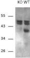 Dscr1 antibody, TA311295, Origene, Western Blot image 