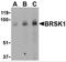 BR Serine/Threonine Kinase 1 antibody, 4083, ProSci, Western Blot image 