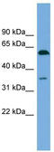 Serum Amyloid A Like 1 antibody, TA340285, Origene, Western Blot image 
