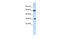 C-Type Lectin Domain Family 4 Member M antibody, 25-765, ProSci, Western Blot image 