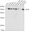Cytoskeleton-associated protein 5 antibody, 23-642, ProSci, Western Blot image 