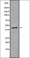 Serpin Family B Member 6 antibody, orb338691, Biorbyt, Western Blot image 